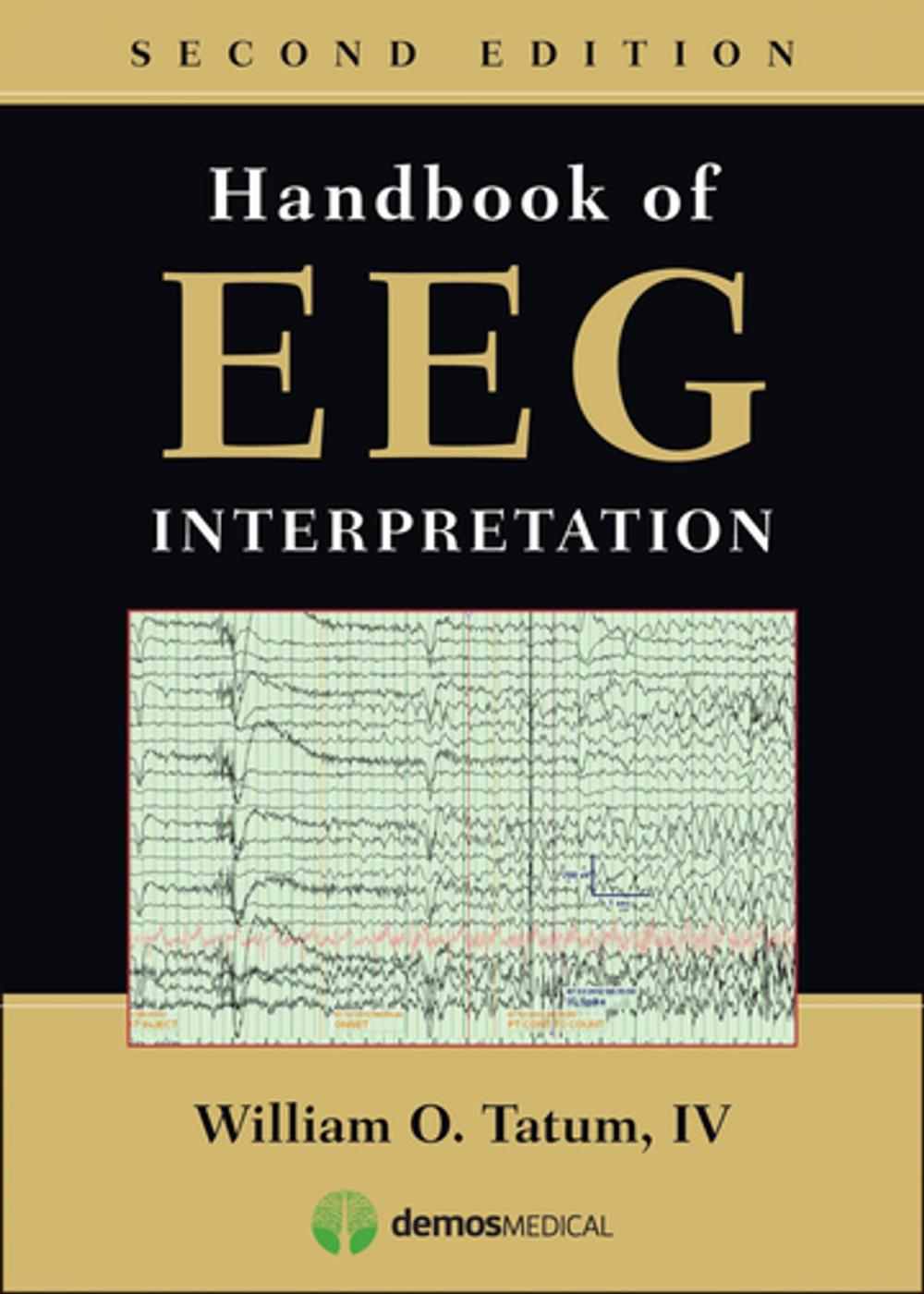 Big bigCover of Handbook of EEG Interpretation, Second Edition
