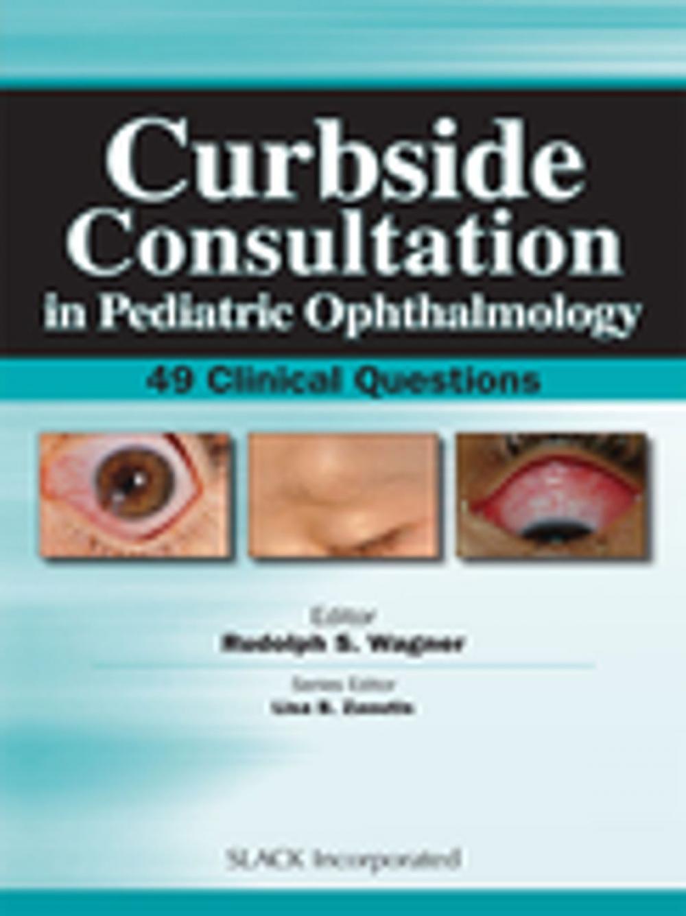 Big bigCover of Curbside Consultation in Pediatric Ophthalmology