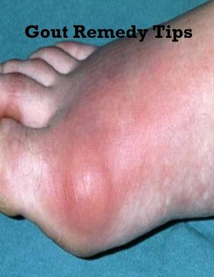 Book cover of Gout Remedy Tips