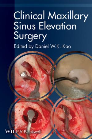 Cover of the book Clinical Maxillary Sinus Elevation Surgery by John Kelly, Steven Male, Drummond Graham