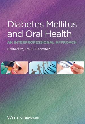 Cover of the book Diabetes Mellitus and Oral Health by Robert J. Anderson, William A. Adams