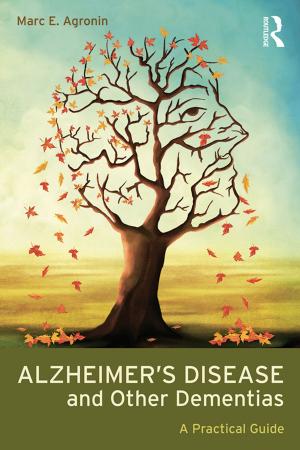 Book cover of Alzheimer's Disease and Other Dementias
