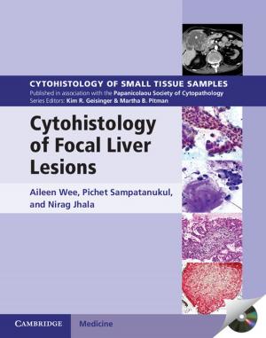 Cover of the book Cytohistology of Focal Liver Lesions by Arjan Zuiderhoek