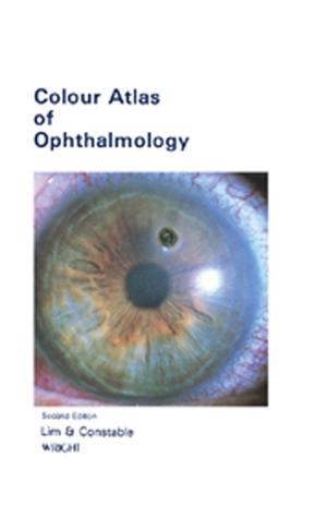 Cover of the book Colour Atlas of Ophthalmology by Dennis P. Nolan