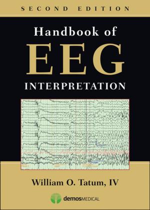 Cover of the book Handbook of EEG Interpretation, Second Edition by Phillip Reeves, MD