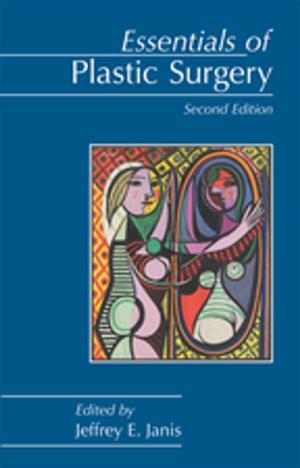 Cover of the book Essentials of Plastic Surgery by Hans Behrbohm, Jacqueline Eichhorn-Sens, Joachim Ulrich Quetz
