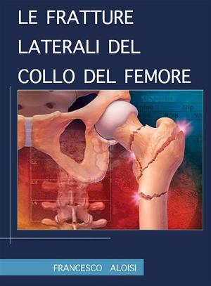 Book cover of Le fratture laterali del collo del femore