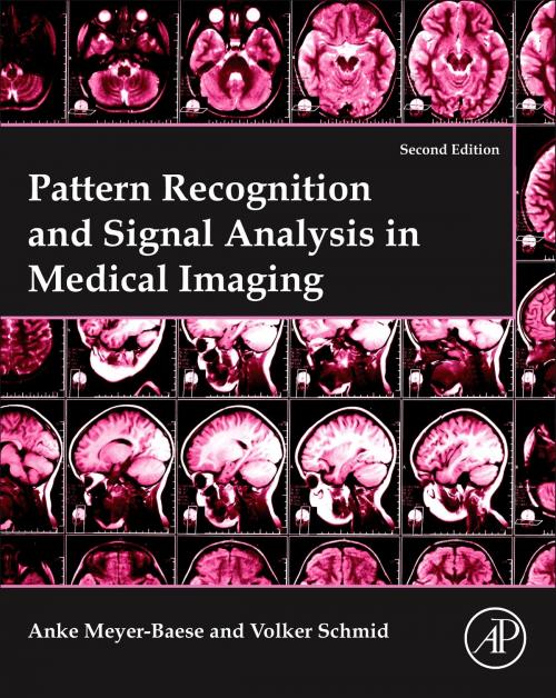 Cover of the book Pattern Recognition and Signal Analysis in Medical Imaging by Anke Meyer-Baese, Volker J. Schmid, Elsevier Science