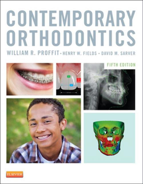 Cover of the book Contemporary Orthodontics - E-Book by William R. Proffit, DDS, PhD, Henry W. Fields Jr., DDS, MS, MSD, David M. Sarver, DMD, MS, Elsevier Health Sciences