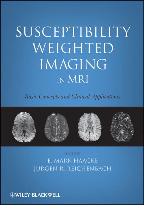 Cover of the book Susceptibility Weighted Imaging in MRI by , Wiley