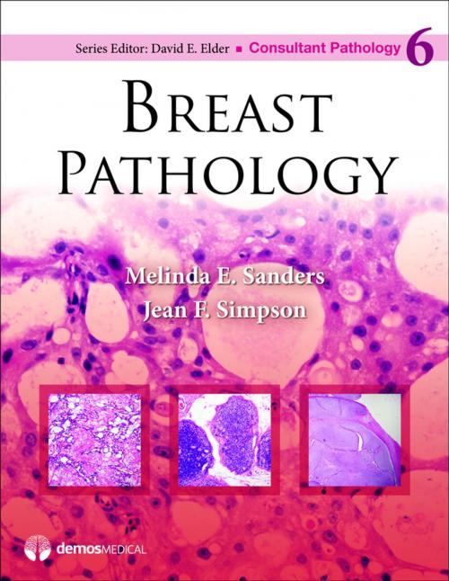 Cover of the book Breast Pathology by David Elder, MD, Chb, Melinda Sanders, MD, Jean Simpson, MD, Springer Publishing Company