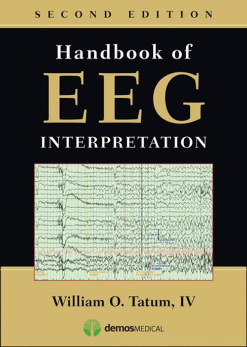 Cover of the book Handbook of EEG Interpretation, Second Edition by William Tatum IV, DO, Springer Publishing Company