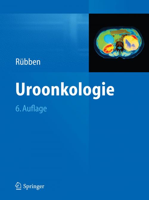 Cover of the book Uroonkologie by , Springer Berlin Heidelberg