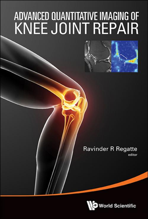 Cover of the book Advanced Quantitative Imaging of Knee Joint Repair by Ravinder R Regatte, World Scientific Publishing Company