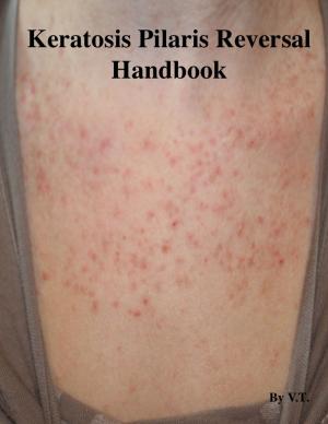 Cover of the book Keratosis Pilaris Reversal Handbook by V.T.