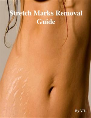 Cover of the book Stretch Marks Removal Guide by Christopher Wong