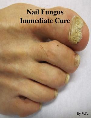 Cover of the book Nail Fungus Immediate Cure by V.T.