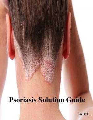 Book cover of Psoriasis Solution Guide
