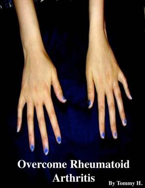 Book cover of Overcome Rheumatoid Arthritis