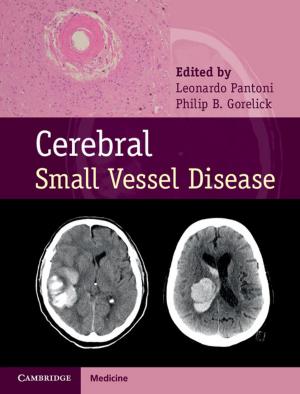 Cover of the book Cerebral Small Vessel Disease by 