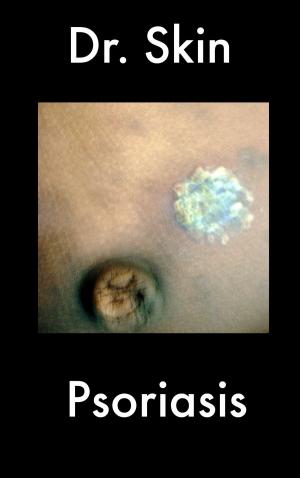 Cover of Psoriasis