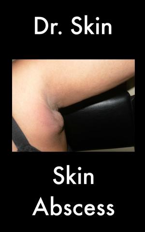 Cover of the book Skin Abscess by Dr Skin