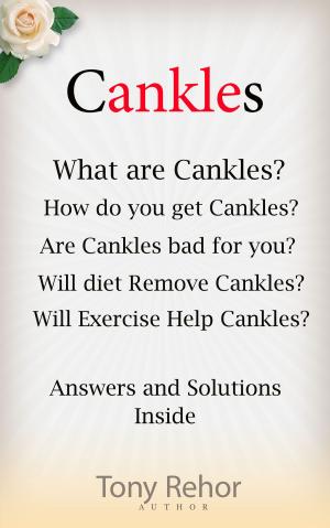 bigCover of the book Cankles by 
