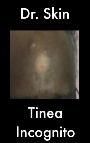 bigCover of the book Tinea Incognito by 