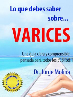 Cover of the book Lo que debes saber sobre... Varices by John P. Turner, Susan B. Turner