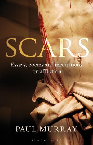 Cover of the book Scars by John David (vormals Premananda)