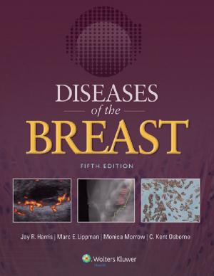 Cover of the book Diseases of the Breast by Stephen S.Burkhart