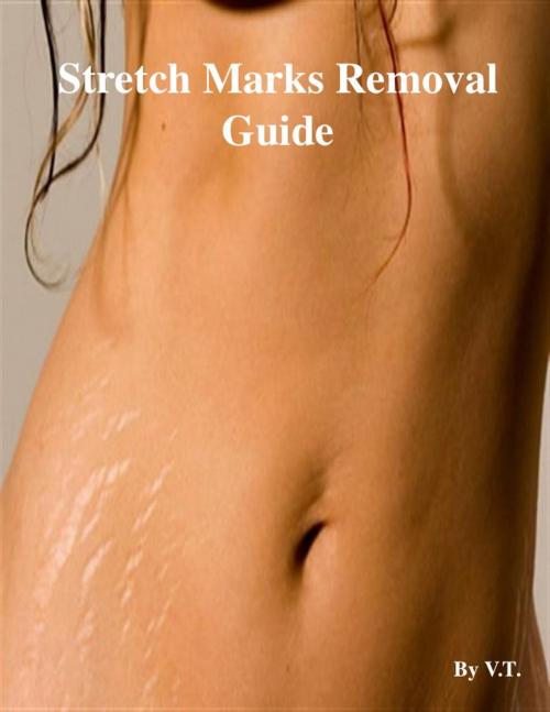 Cover of the book Stretch Marks Removal Guide by V.T., V.T.