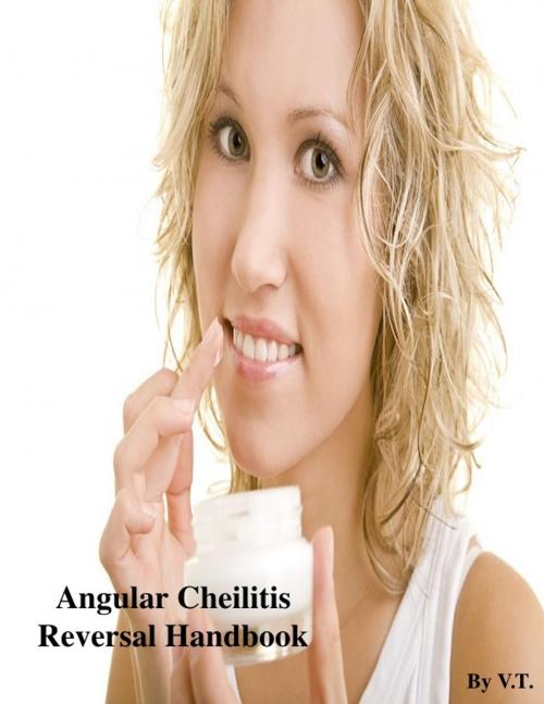 Cover of the book Angular Cheilitis Reversal Handbook by V.T., V.T.