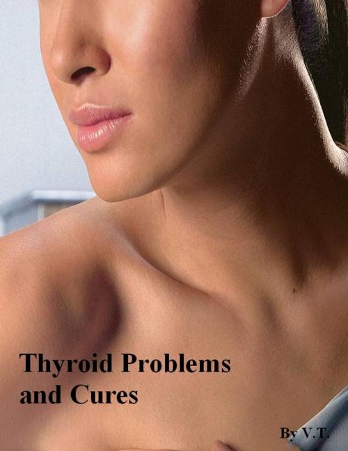 Cover of the book Thyroid Problems and Cures by V.T., V.T.