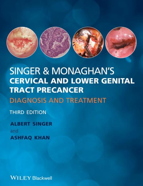 Cover of the book Singer and Monaghan's Cervical and Lower Genital Tract Precancer by Albert Singer, Ashfaq Khan, Wiley