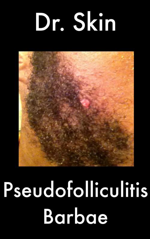 Cover of the book Pseudofolliculitis Barbae by Dr Skin, Dr Skin