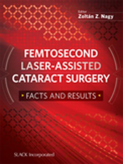 Cover of the book Femtosecond Laser-Assisted Cataract Surgery by , SLACK Incorporated