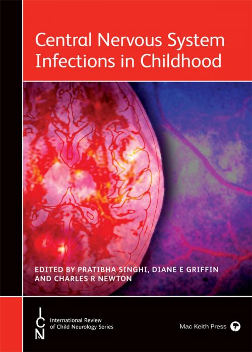 Cover of the book Central Nervous System Infections in Childhood by Pratibha  Singhi, Diane E Griffin, Charles R Newton, Mac Keith Press