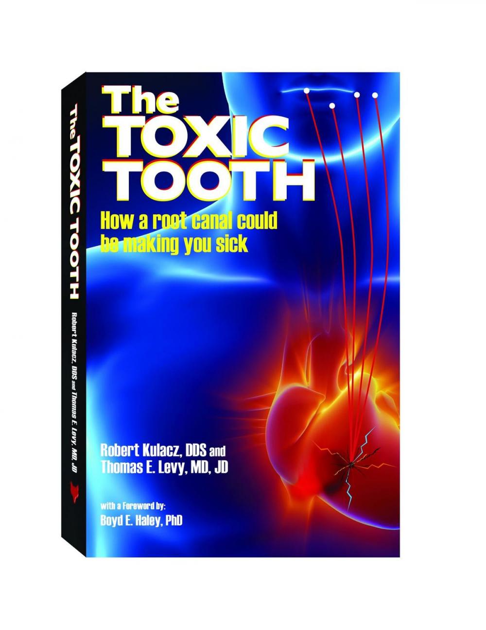 Big bigCover of The Toxic Tooth