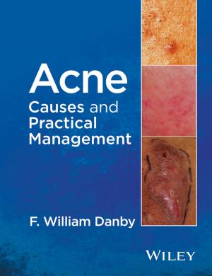 Cover of the book Acne by Jerome D. Waye, James Aisenberg, Peter H. Rubin