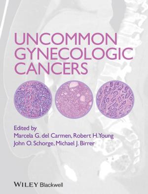 bigCover of the book Uncommon Gynecologic Cancers by 