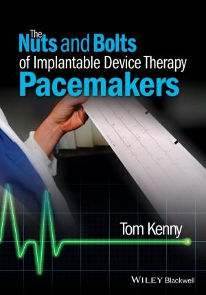 Cover of the book The Nuts and Bolts of Implantable Device Therapy by Institute of Management and Administration (IOMA)