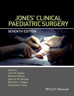 Cover of the book Jones' Clinical Paediatric Surgery by Andre S. Merbach, Lothar Helm, Éva Tóth