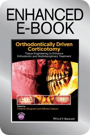 Cover of the book Orthodontically Driven Corticotomy by Tracy Repchuk