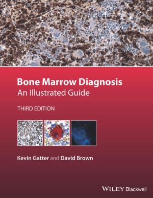 Cover of the book Bone Marrow Diagnosis by Kenneth W. Boyd