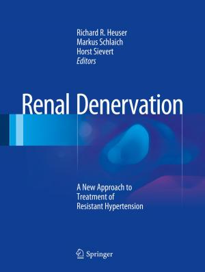 Cover of the book Renal Denervation by Diego Martínez, Manuel Berenguel, Eduardo F. Camacho, Francisco R. Rubio