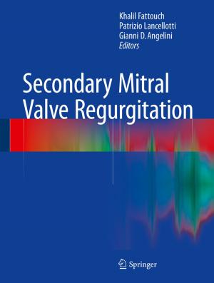 Cover of the book Secondary Mitral Valve Regurgitation by Miroslav Premrov, Vesna Žegarac Leskovar