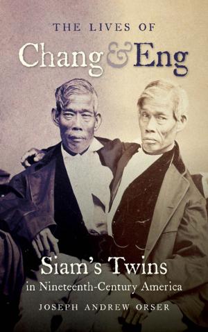 Cover of the book The Lives of Chang and Eng by William Ferris
