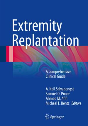Cover of the book Extremity Replantation by Jules H. Gilder