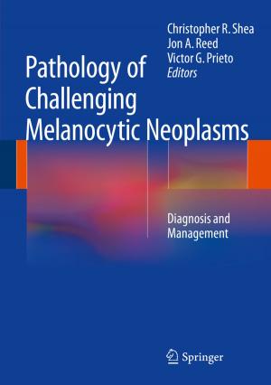 Cover of the book Pathology of Challenging Melanocytic Neoplasms by D.A. Klyushin, S.I. Lyashko, D.A. Nomirovskii, Yu.I. Petunin, Vladimir Semenov